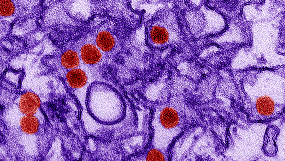 April finally two mouse models to combat zika virus