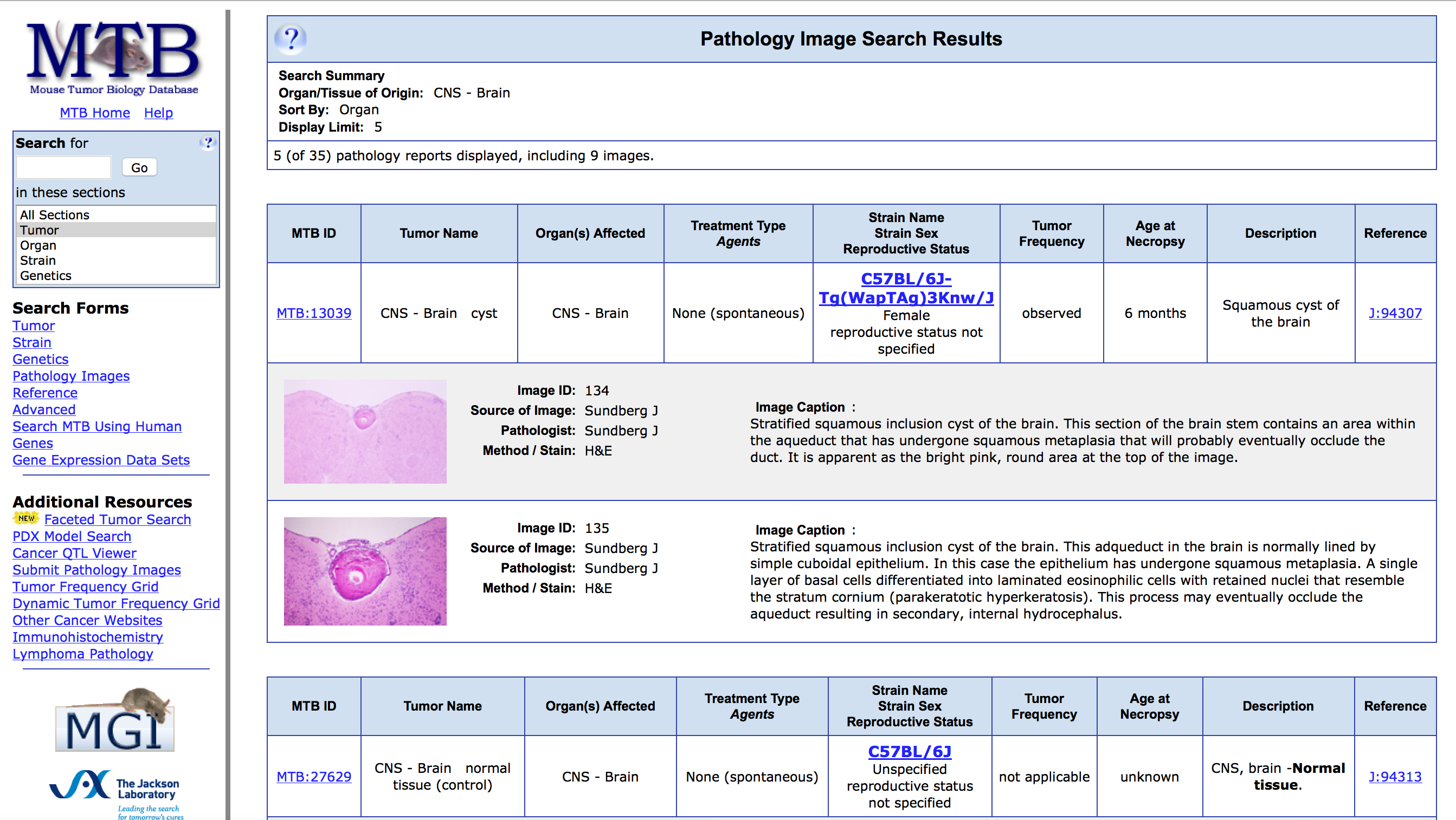 MTB Pathology Image Search Results