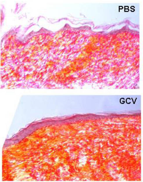 scar tissue in JAX transgenic p16-3MR mice