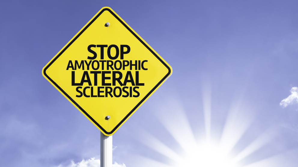 amytrophic lateral sclerosis