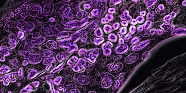 A gif of cancer cells, tinted purple.