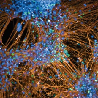 A square crop of neuronal progenitor cells from Martin Pera's research.