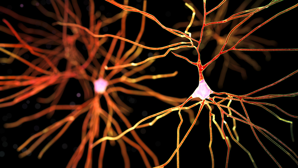 Alzheimer's research, neurons, 3D neurons