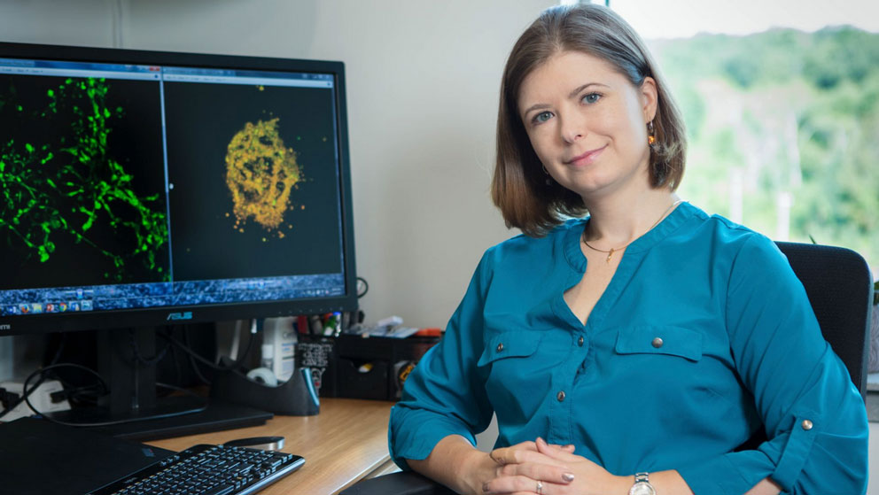 Olga Anczuków is exploring this fundamental process to discover new treatments for breast cancer
