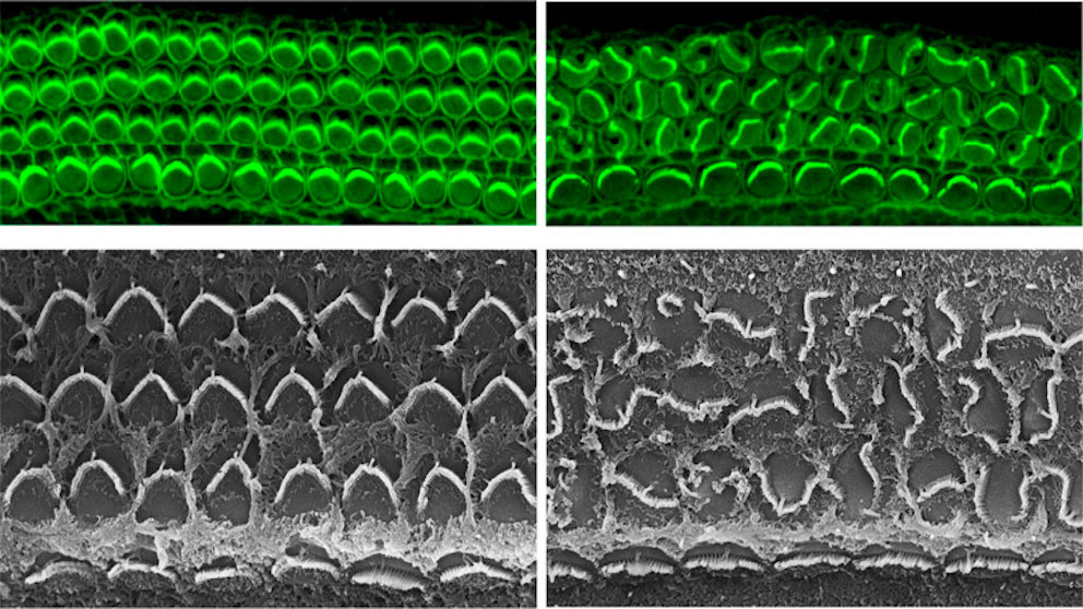 Inner ear hair cell organization in mice with (left) and lacking (right) the protein Daple