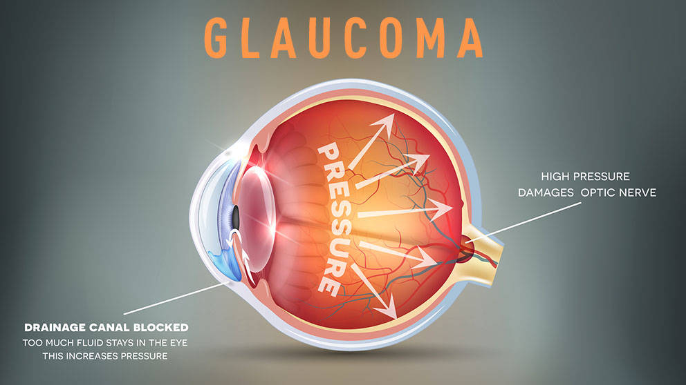 JAX Associate Professor Gareth Howell, Ph.D., is teaming up with the University of Rochester Medical Center’s Richard Libby, Ph.D., to determine how the endothelin system contributes to retinal cell death in glaucoma.