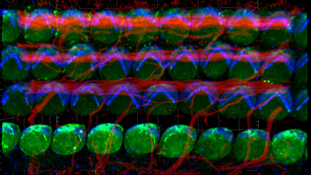 detailed slow scanning stack of the auditory epithelium of a young postnatal mouse. 